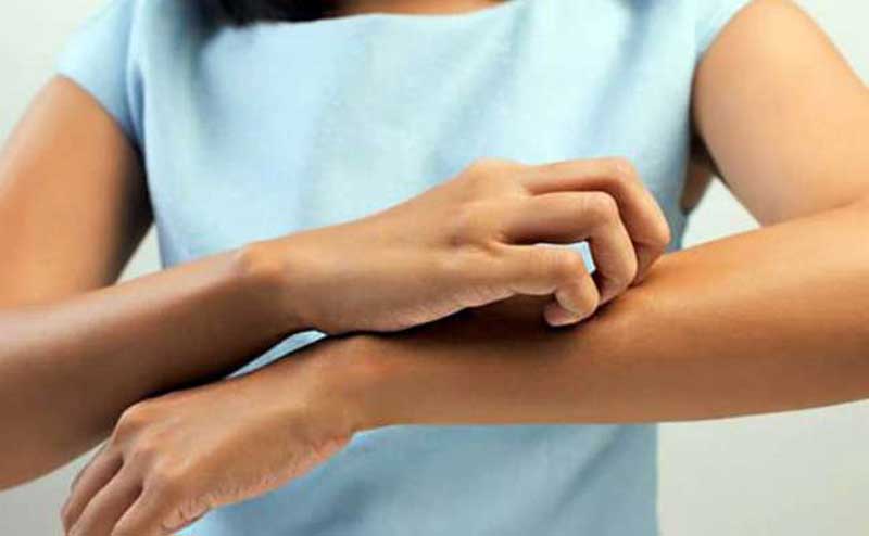 যেসব কারণে অ্যালার্জি হয় - West Bengal News 24