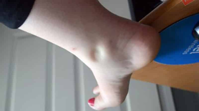 শরীরে জল জমার ৫ টি কারণ ও এর প্রতিকারের উপায় - West Bengal News 24