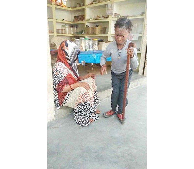 সাপের মতো চামড়া খসে যায় ভারতীয় কিশোরীর! রহস্য নয়, ঘোর বাস্তব - West Bengal News 24 সাপের মতো চামড়া খসে যায় ভারতীয় কিশোরীর! রহস্য নয়, ঘোর বাস্তব - West Bengal News 24
