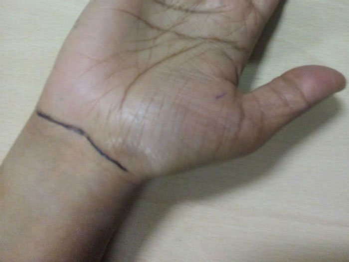 কব্জির রেখা দেখে এত সবকিছু জানা সম্ভব! - West Bengal News 24