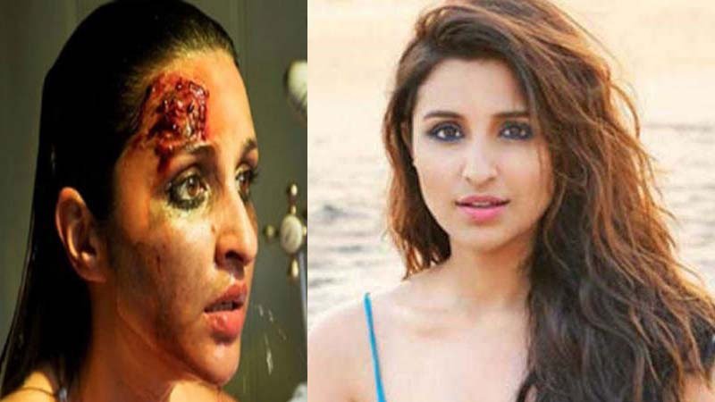 মাথা ফেটে রক্ত ঝরছে পরিণীতি চোপড়ার! - West Bengal News 24