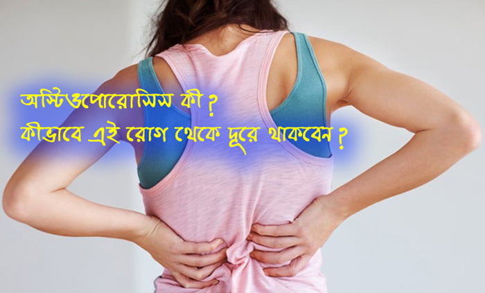 অস্টিওপোরোসিস কী? কীভাবে এই রোগ থেকে দূরে থাকবেন? - West Bengal News 24