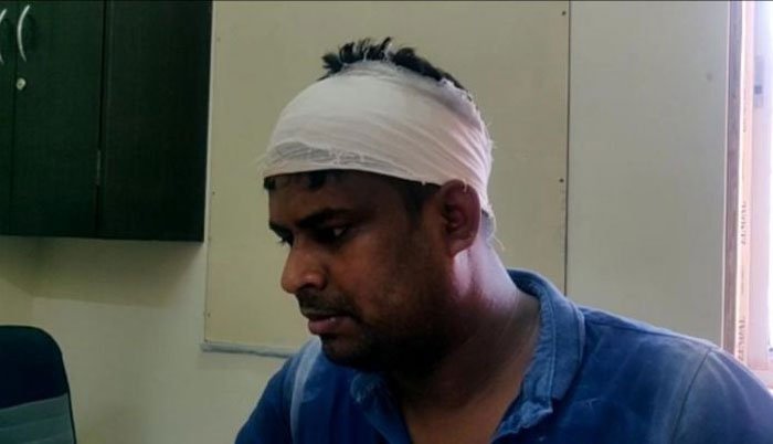 মুখ্যমন্ত্রীর নামে কুরুচিকর মন্তব্যের অভিযোগ, তদন্তে গিয়ে আহত দুই পুলিশকর্মী ! - West Bengal News 24