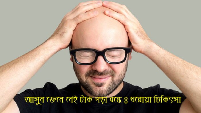 আসুন জেনে নেই টাক পড়া বন্ধে ৪ ঘরোয়া চিকিৎসা - West Bengal News 24