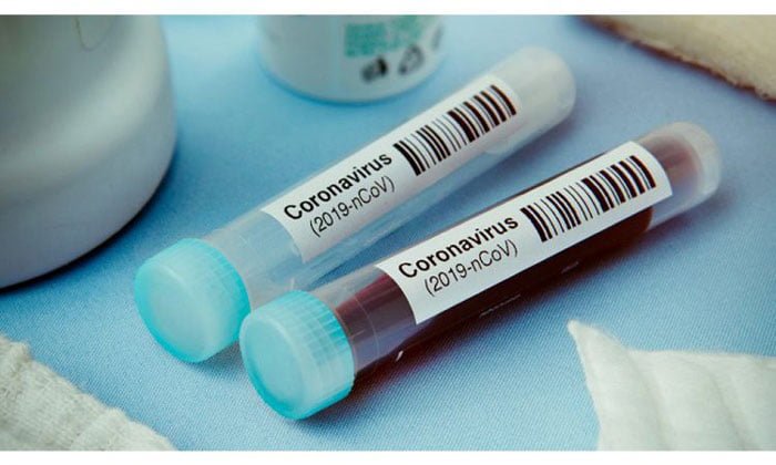 করোনা রোগীদের জন্য সুখবর, জেনে নিন ! - West Bengal News 24