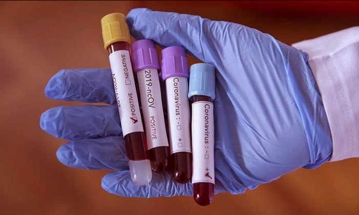 কোয়ারান্টিন থাকার পরেও কলকাতায় করোনা আক্রান্ত দুই ঢাকা ফেরত যাত্রী ! - West Bengal News 24