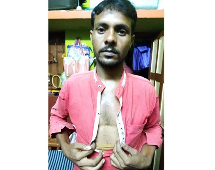 বিজেপি করায় সারা শরীরে কামড় ও মারধর - West Bengal News 24