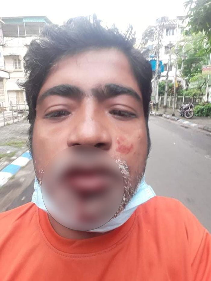 মোদীর মন কি বাত অনুষ্ঠান কে কেন্দ্র করে তৃনমুলের হামলার শিকার বাবান ঘোষ ও বিজেপি কর্মীরা - West Bengal News 24 মোদীর মন কি বাত অনুষ্ঠান কে কেন্দ্র করে তৃনমুলের হামলার শিকার বাবান ঘোষ ও বিজেপি কর্মীরা - West Bengal News 24