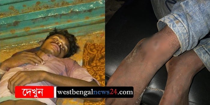 পিক-আপ ভ্যান থামিয়ে প্রকৃতির ডাকে সাড়া দিতে গিয়ে সাপের ছোবলে অসুস্থ চালক - West Bengal News 24