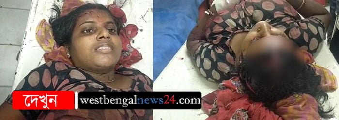 কুপ্রস্তাবে সাড়া না দেওয়ায় এক গৃহবধূকে ধারালো অস্ত্রের কোপ যুবকের - West Bengal News 24