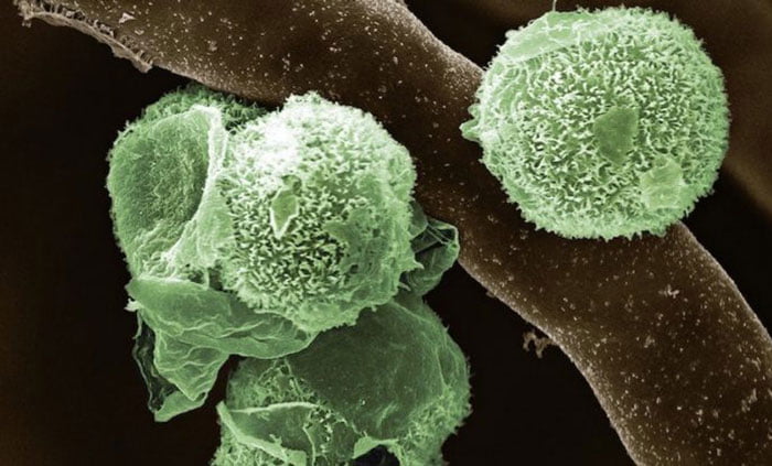 এ বার ‘গ্রিন ফাঙ্গাস’ ধরা পড়ল ভারতে! - West Bengal News 24