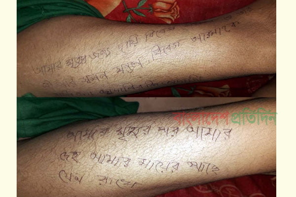 দুই পায়ে মৃত্যুর কারণ ও দায়ীদের নাম লিখে গেলেন গৃহবধূ - West Bengal News 24