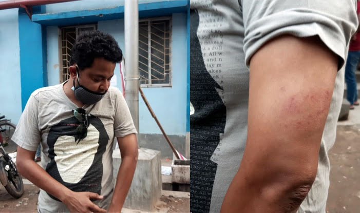 বর্ধমানে বিজেপি নেতাকে মারধরের অভিযোগ - West Bengal News 24 বর্ধমানে বিজেপি নেতাকে মারধরের অভিযোগ - West Bengal News 24