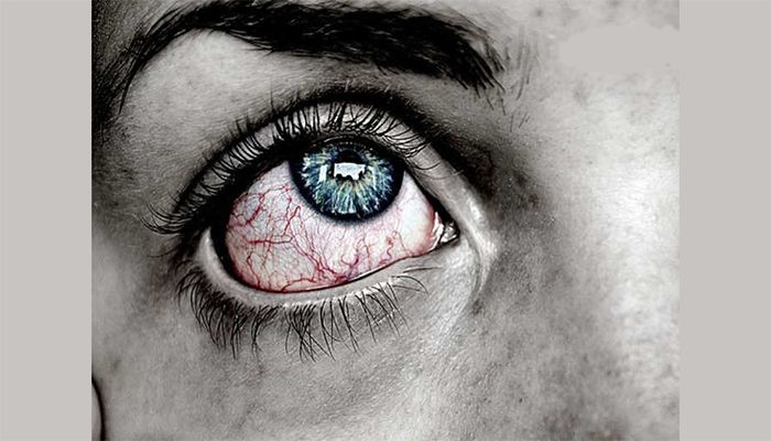 ব্ল্যাক ফাঙ্গাসে চোখ হারালো মুম্বাইের তিন শিশু - West Bengal News 24