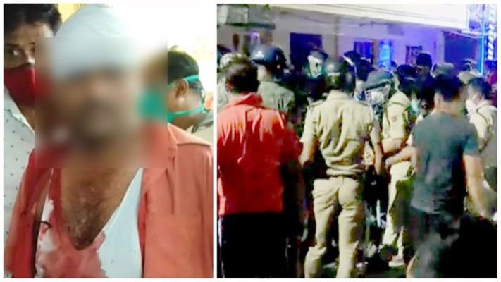 হামলায় মাথা ফাটল তৃণমূল নেতার, আক্রান্ত সাংবাদিক, ধৃত বিজেপি বিধায়কের ভাই - West Bengal News 24 হামলায় মাথা ফাটল তৃণমূল নেতার, আক্রান্ত সাংবাদিক, ধৃত বিজেপি বিধায়কের ভাই - West Bengal News 24