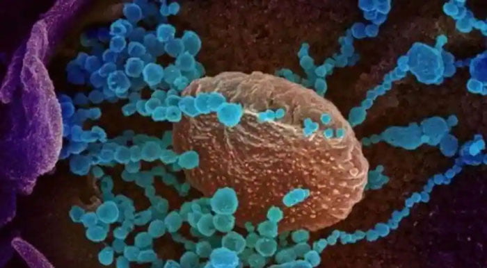 COVID-19 Strain 'Lambda' : করোনার নতুন প্রজাতি ‘ল্যাম্বডার’ আতঙ্কে ২৯টি দেশ, চিন্তিত বিশ্ব স্বাস্থ্য সংস্থা - West Bengal News 24 COVID-19 Strain 'Lambda' : করোনার নতুন প্রজাতি ‘ল্যাম্বডার’ আতঙ্কে ২৯টি দেশ, চিন্তিত বিশ্ব স্বাস্থ্য সংস্থা - West Bengal News 24