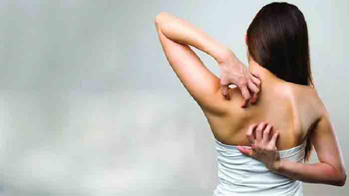 এবার ঘরোয়া উপায়ে হবে চুলকানির সমস্যা সমাধান, জানুন পদ্ধতি - West Bengal News 24