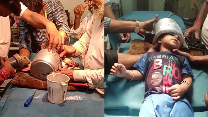 প্রেসার কুকারের মধ্যে মাথা আটকে গেলো শিশুর, দু-ঘণ্টার চেষ্টায় বাঁচালেন ডাক্তারবাবুরা - West Bengal News 24