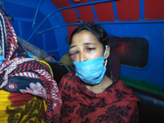 দাম্পত্য কলহের জের! স্ত্রীকে চড়,কিল,ঘুঁসি স্বামীর, থানায় অভিযোগ দায়ের গৃহবধুর - West Bengal News 24 দাম্পত্য কলহের জের! স্ত্রীকে চড়,কিল,ঘুঁসি স্বামীর, থানায় অভিযোগ দায়ের গৃহবধুর - West Bengal News 24