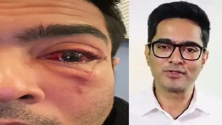 Abhishek Banerjee : ফের অভিষেকের চোখে অস্ত্রোপচার, ট্যুইটে বিরোধীদের নিশানা কুণালের - West Bengal News 24