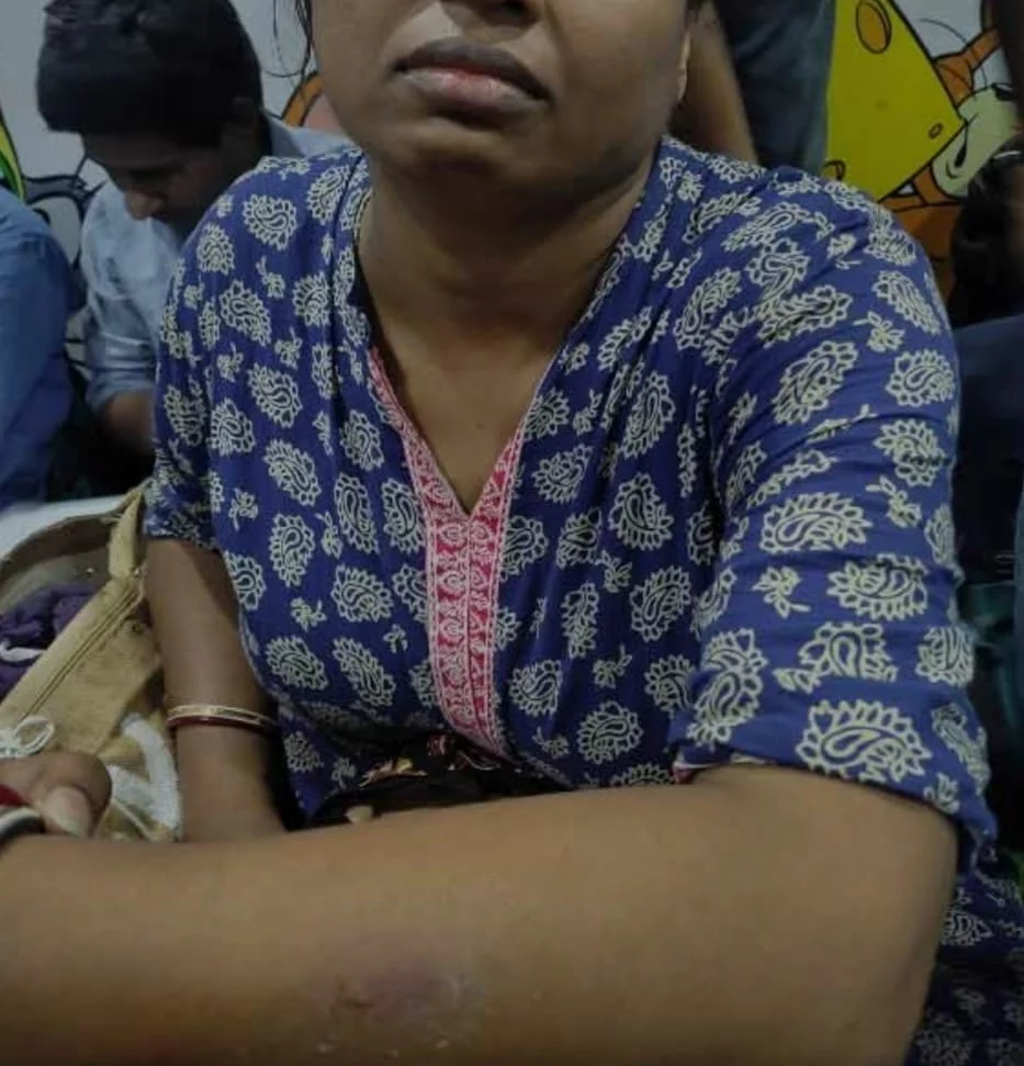 চাকরিপ্রার্থীর হাতে কামড় পুলিশ কর্মীর - West Bengal News 24 চাকরিপ্রার্থীর হাতে কামড় পুলিশ কর্মীর - West Bengal News 24