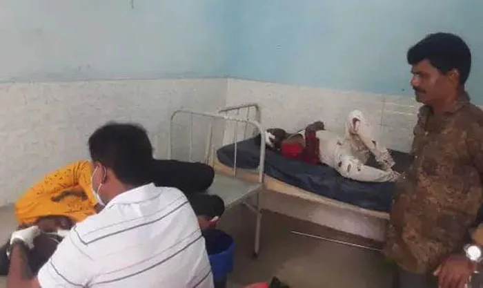 আদালত থেকে ফেরার পথে মহিলা আইনজীবীর স্কুটিতে ধাক্কা বাইকের, আহত তিন - West Bengal News 24